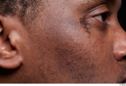 Face Cheek Ear Skin Man Black Scar Slim Studio photo references
